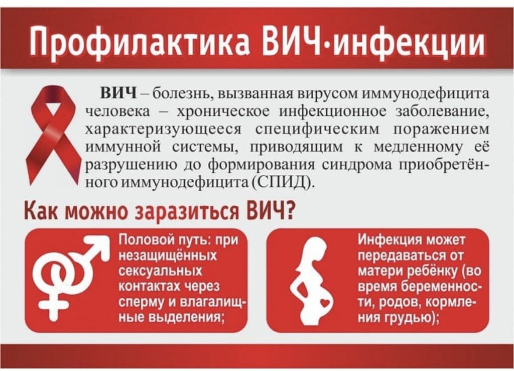 Profilaktika VICH infekcii